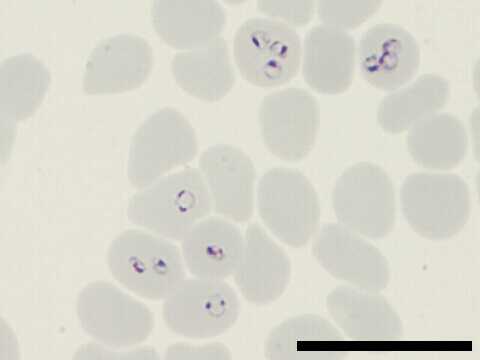 Plasmodium falciparum