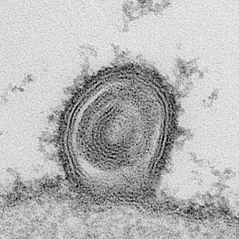 単純ヘルペスウイルス1型