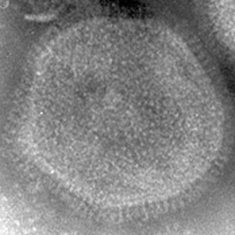 A型インフルエンザウイルス