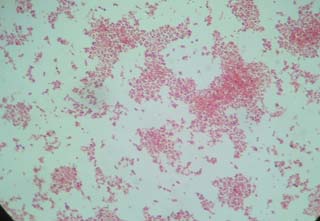 pneumonia23