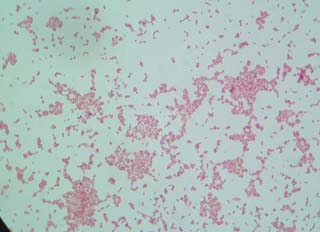 pneumonia24