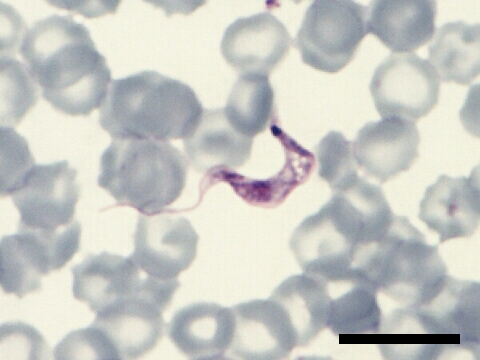 Trypanosoma cruzi