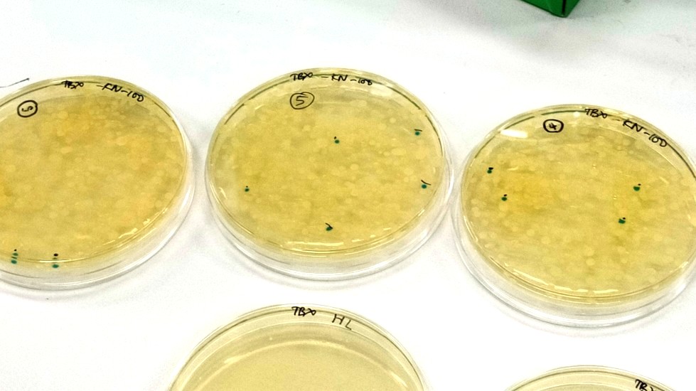 結果（川の水：100倍希釈_濃紺に染色されている点が大腸菌）